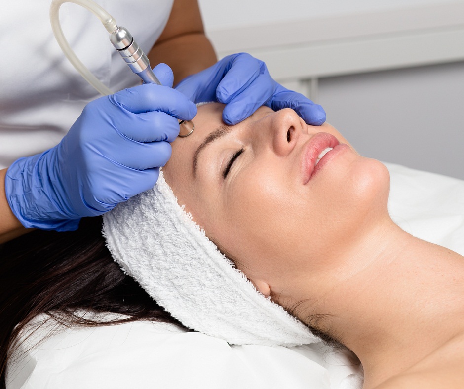 Microdermabrasion